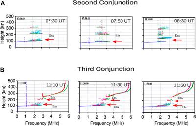 The role of the inner radiation belt dynamic in the generation of auroral-type sporadic E-layers over south American magnetic anomaly